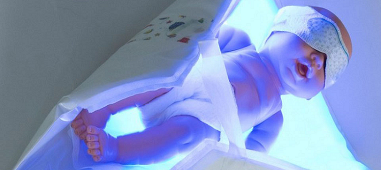 phototherapy for newborns